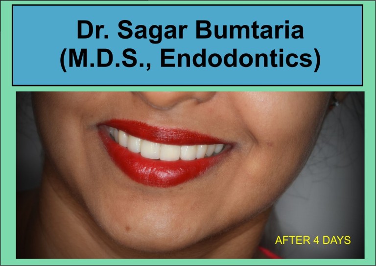 best dentist in jamnagar