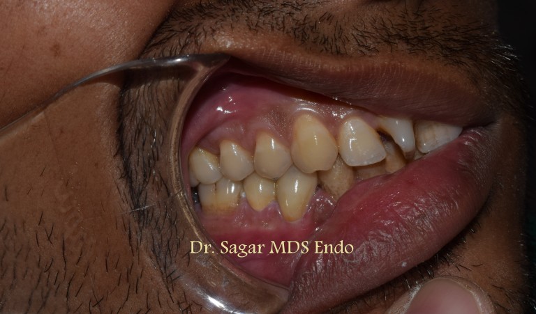 dentist in jamangar