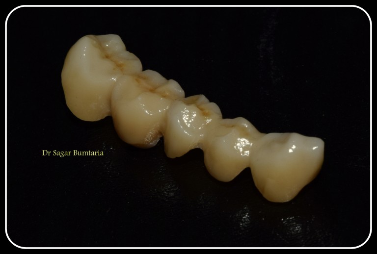 dentist in jamangar