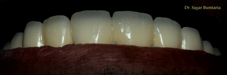 best dentist in jamnagar