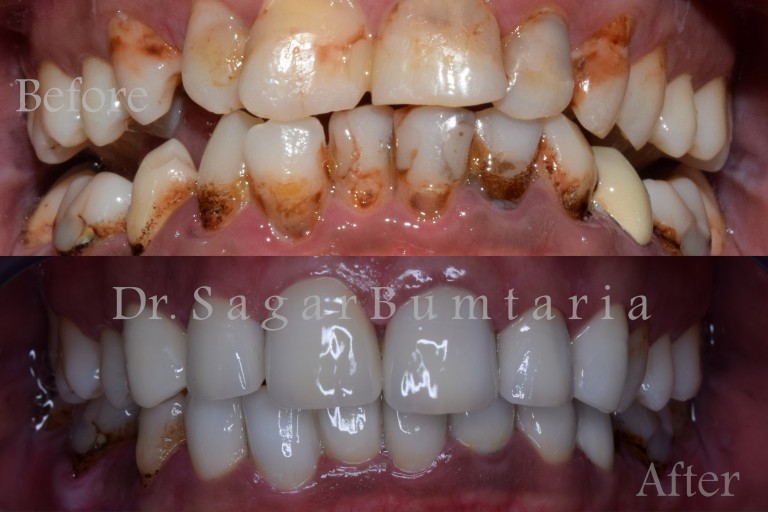 dentist in jamangar