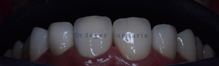 dentist in jamangar