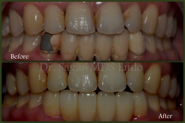 best dentist in jamnagar