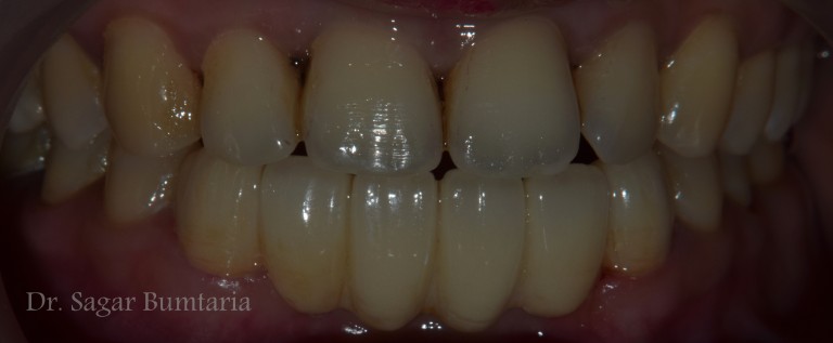 best dentist in jamnagar
