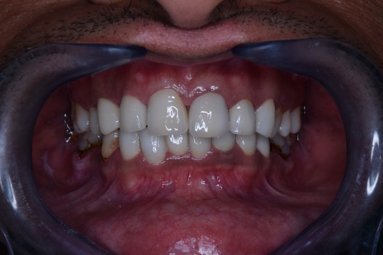 dentist in jamangar