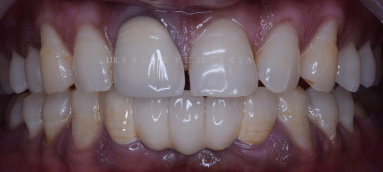 best dentist in jamnagar
