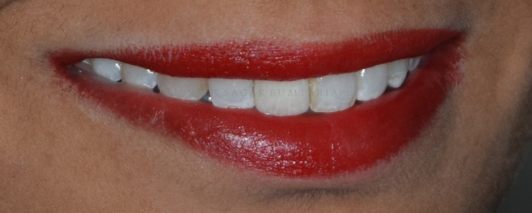 dentist in jamangar