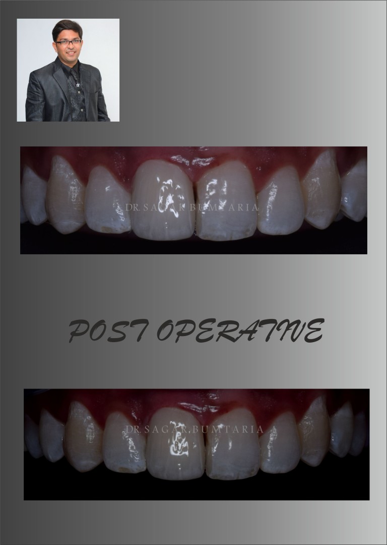 dentist in jamangar