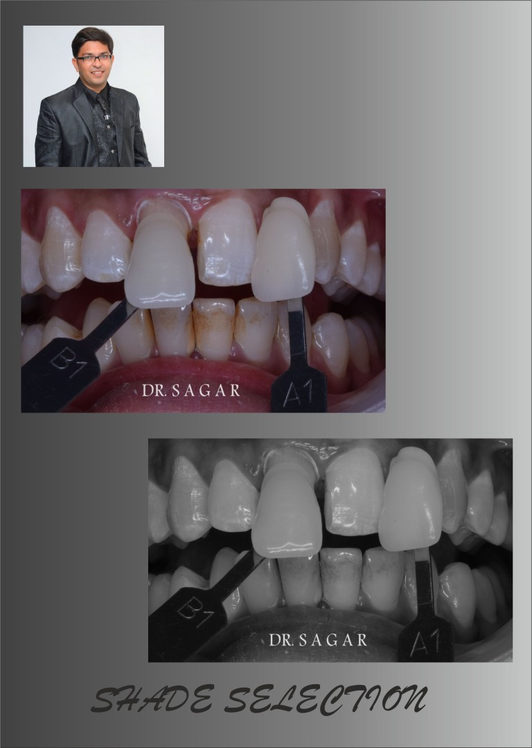 best dentist in jamnagar