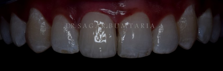 best dentist in jamnagar