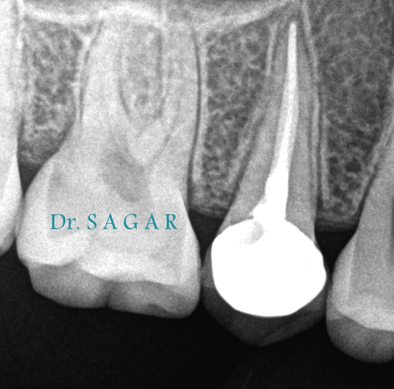 dentist in jamangar