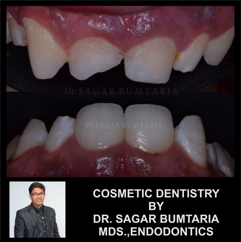 best dentist in jamnagar