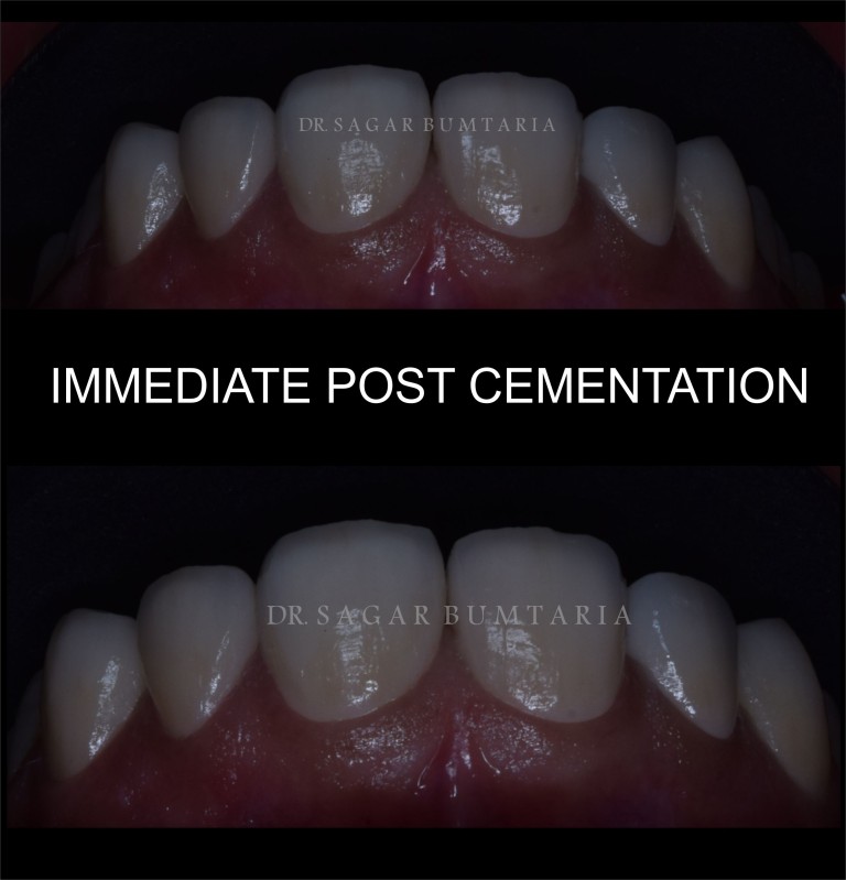 best dentist in jamnagar