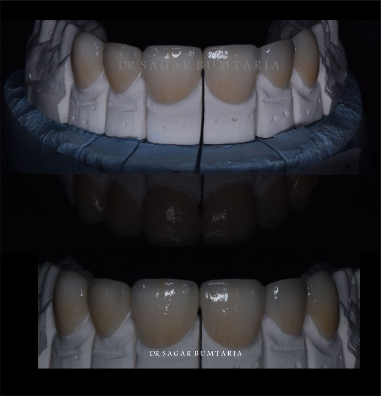 dentist in jamangar