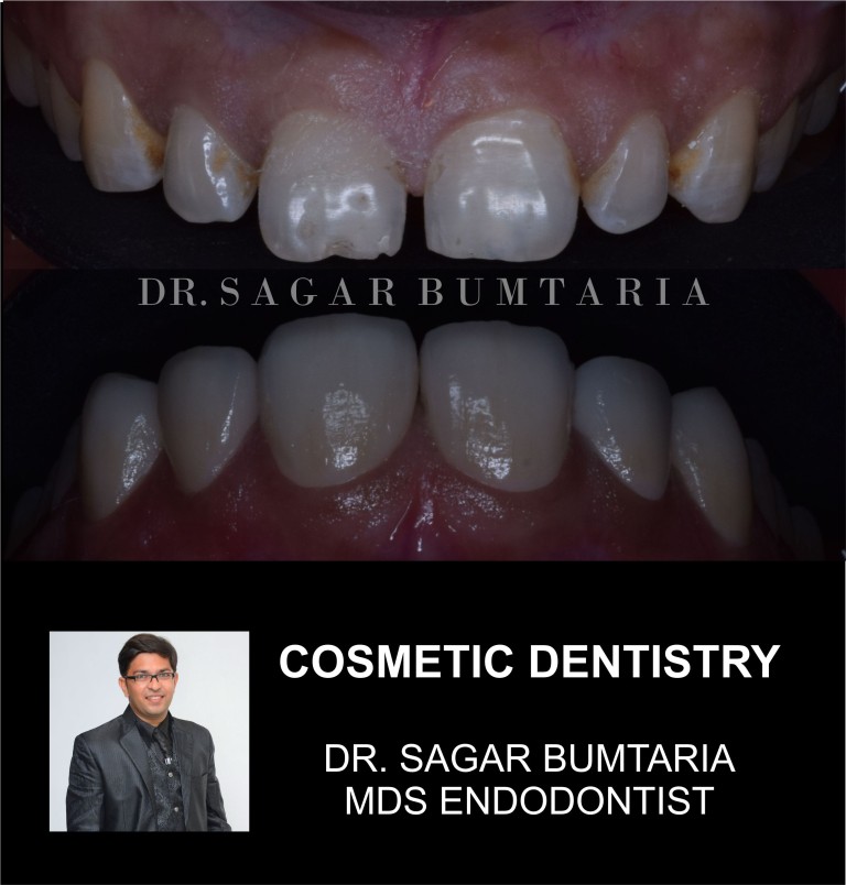 best dentist in jamnagar