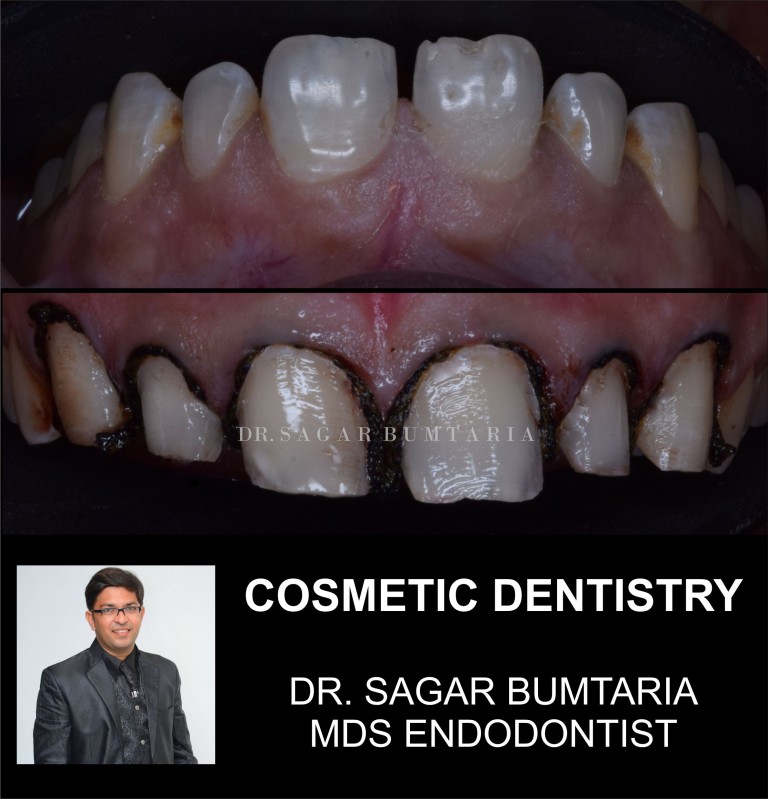 best dentist in jamnagar
