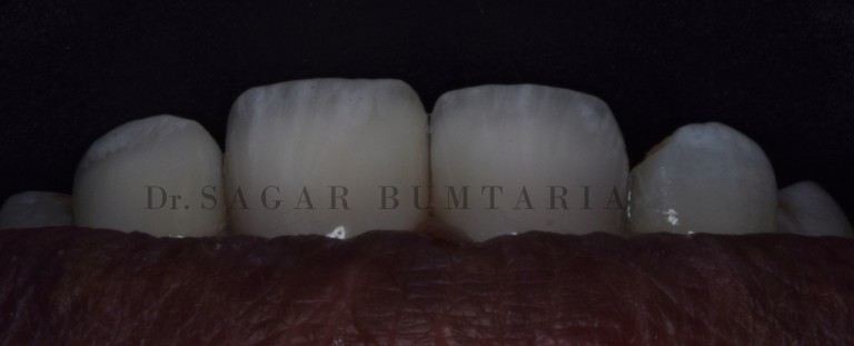 best dentist in jamnagar