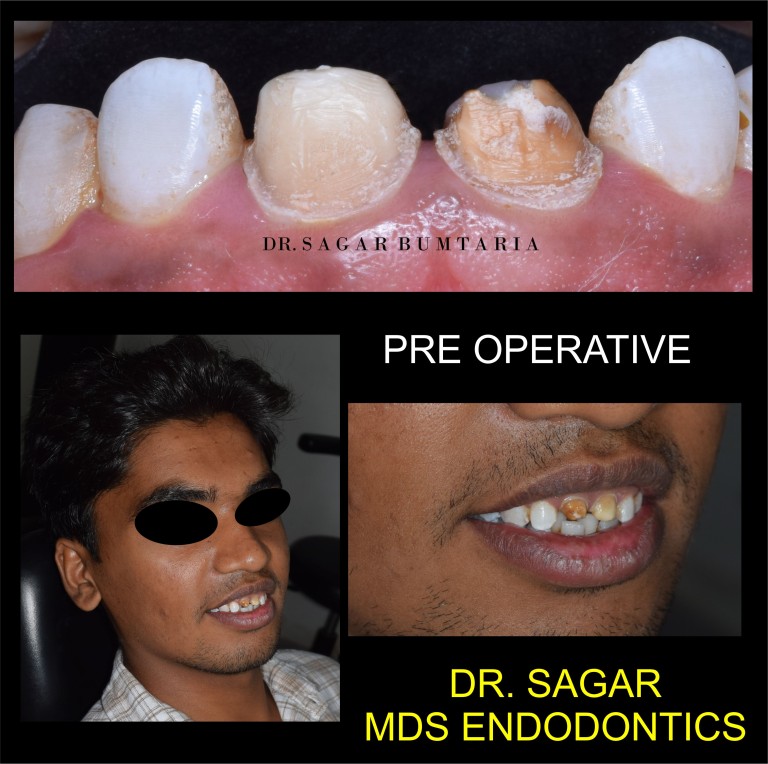 dentist in jamangar