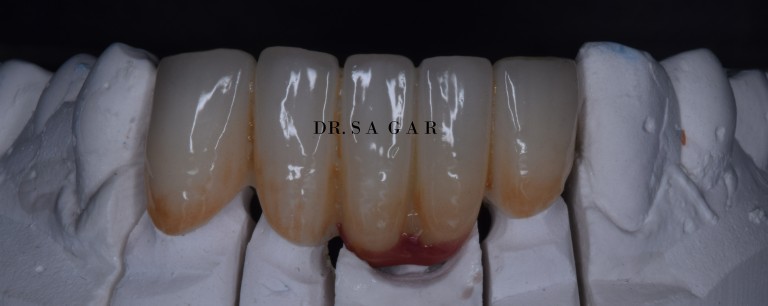 dentist in jamangar
