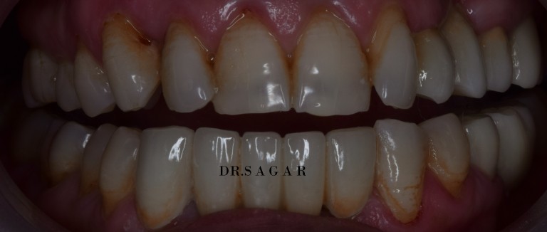 dentist in jamangar