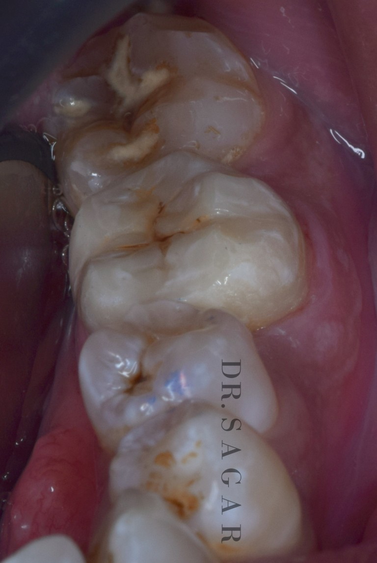 best dentist in jamnagar