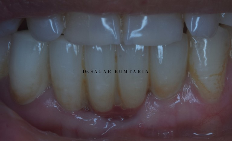 best dentist in jamnagar