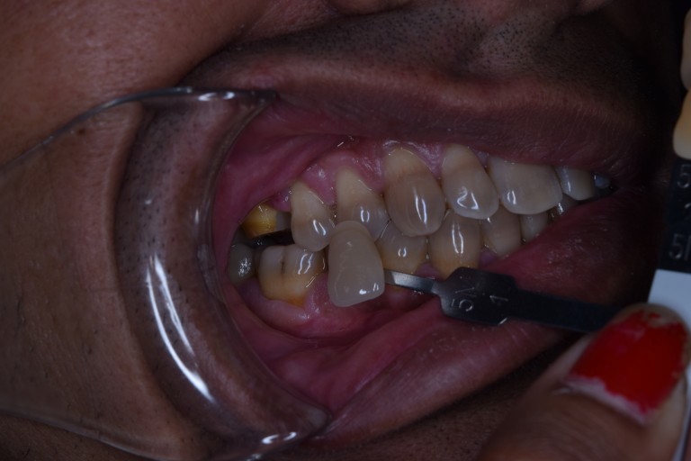 dentist in jamangar