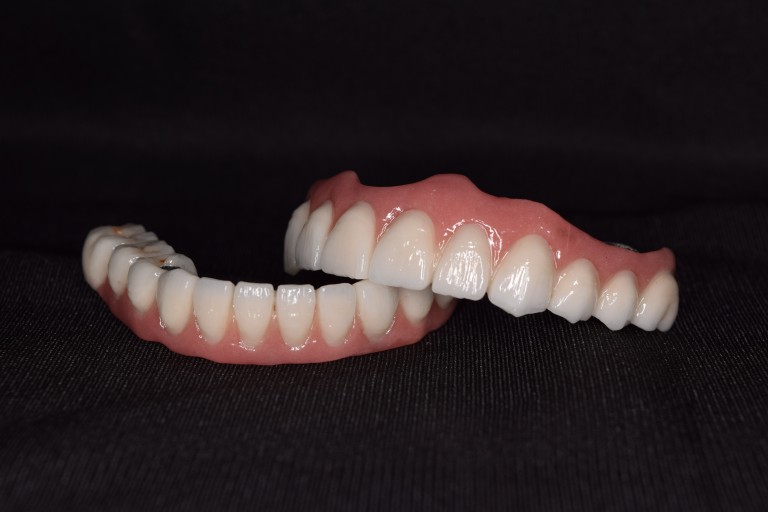 Full Mouth Inhabilitation