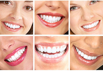 Smile Designing